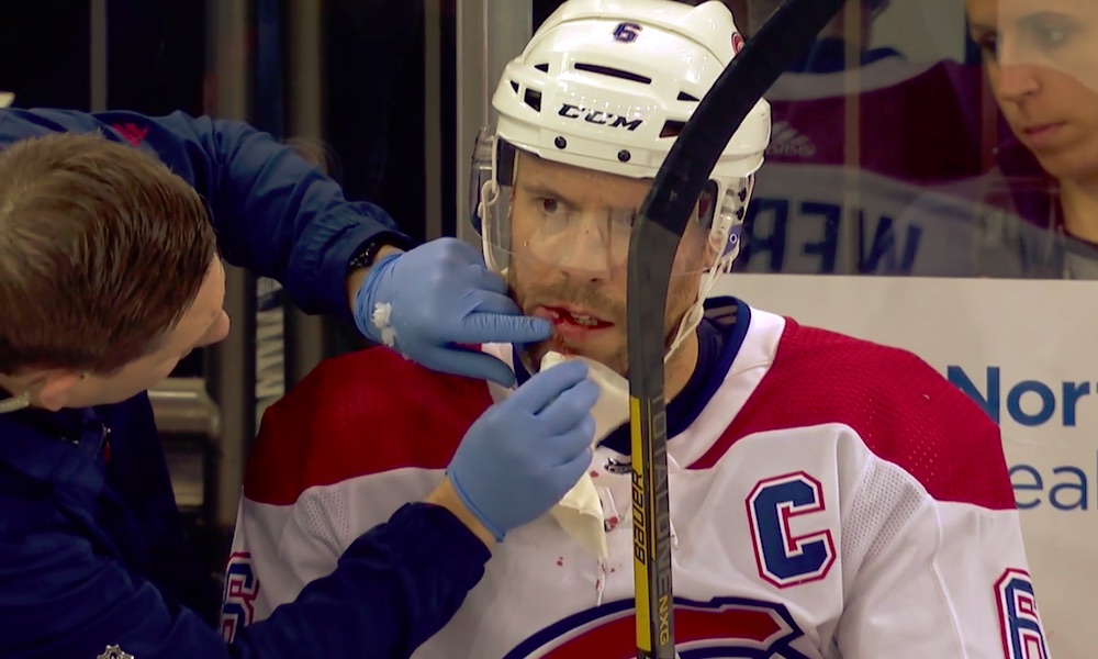 Montreal Canadiensin Shea Weber blokkasi laukauksen naamallaan: NY Rangersin Ryan Strome tälläsi kiekon suoraan kanadalaispuolustajan kasvoihin.